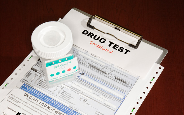 rsz-does-CBD-show-up-in-a-drug-test